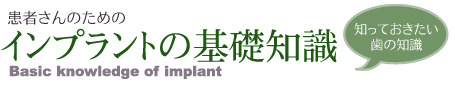 患者さんのためのインプラントの基礎知識